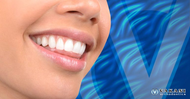 How Long Does Clear Aligner Treatment Take? Your Complete Guide to a Straighter Smile in Stuart, Port St. Lucie, Fort Pierce, Vero Beach & Palm Bay