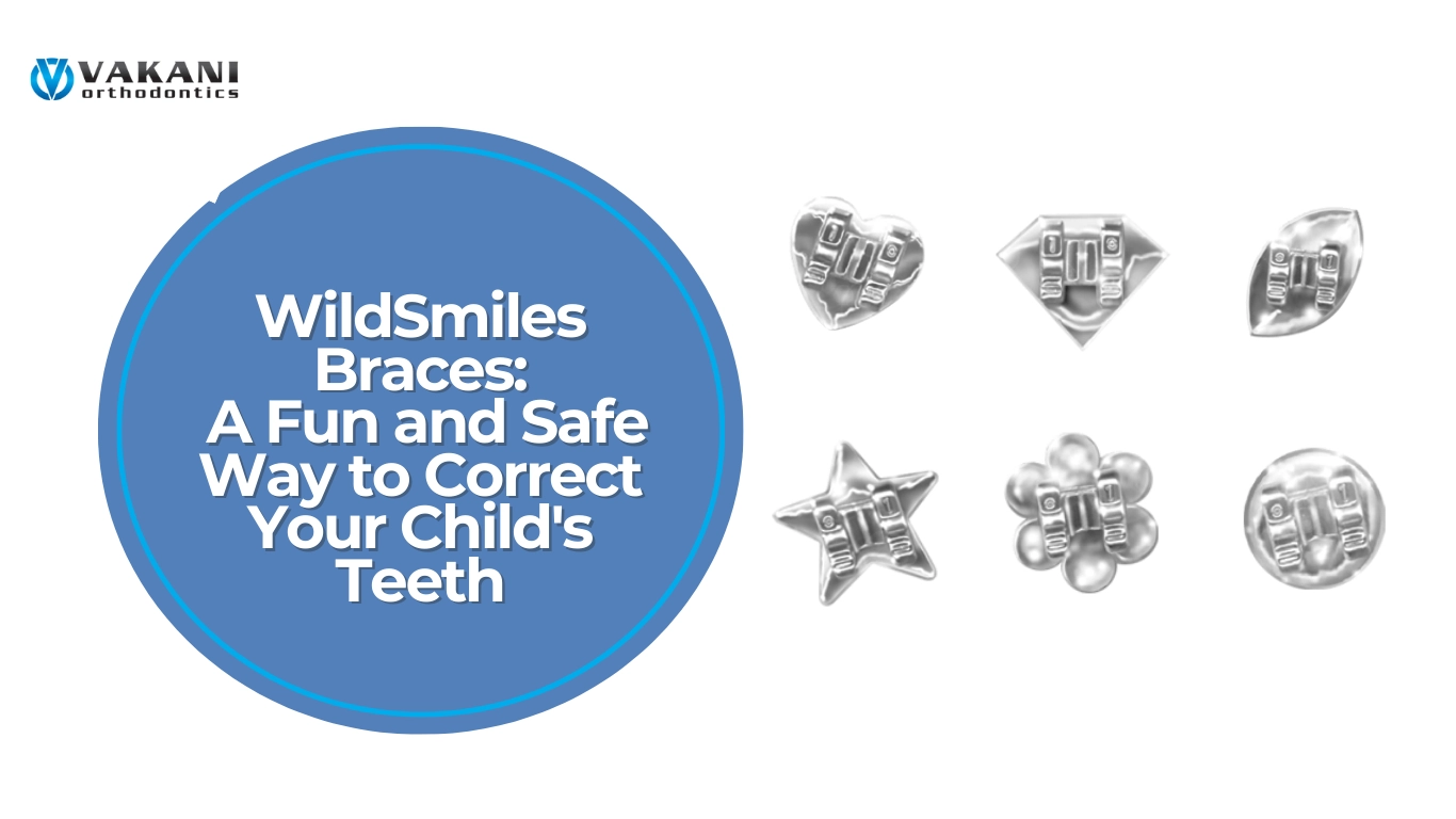 WildSmiles Braces: A Fun and Safe Way to Correct Your Child’s Teeth