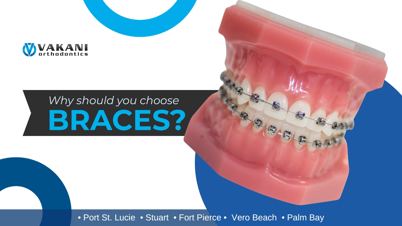 Why Should You Choose Braces? in Vero Beach, Fort Pierce, Stuart, and Palm Bay, FL